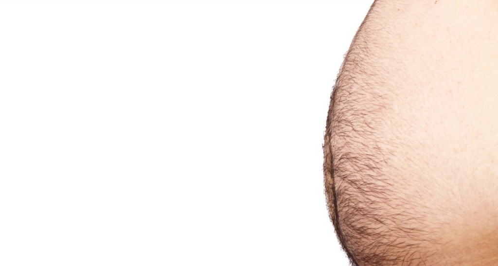 obezita náš postrah prečo je stále viac ľudí tučných aj keď nemusí pohyb.sk